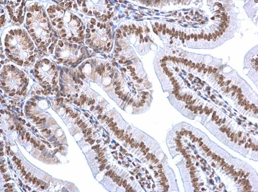 HMGB1 Antibody in Immunohistochemistry (Paraffin) (IHC (P))