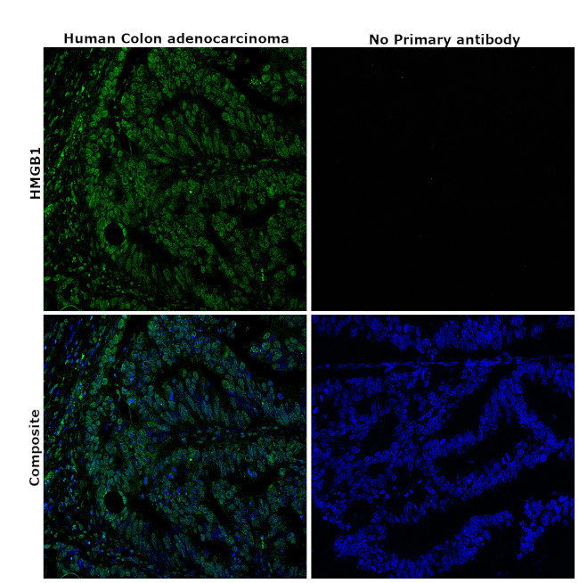 HMGB1 Antibody in Immunohistochemistry (Paraffin) (IHC (P))