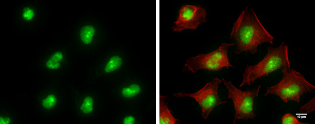 ADAR Antibody in Immunocytochemistry (ICC/IF)