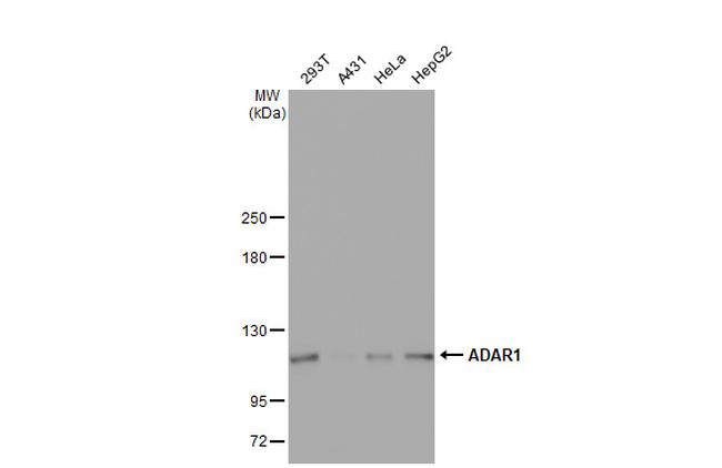 ADAR Antibody in Western Blot (WB)