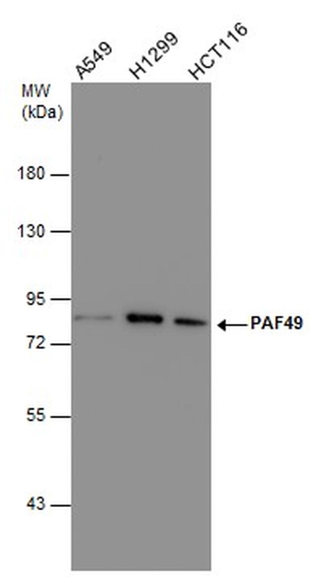 PAF49 Antibody in Western Blot (WB)