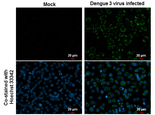 Dengue Virus Type 2 Envelope Antibody in Immunocytochemistry (ICC/IF)