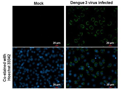 Dengue Virus Type 2 Envelope Antibody in Immunocytochemistry (ICC/IF)