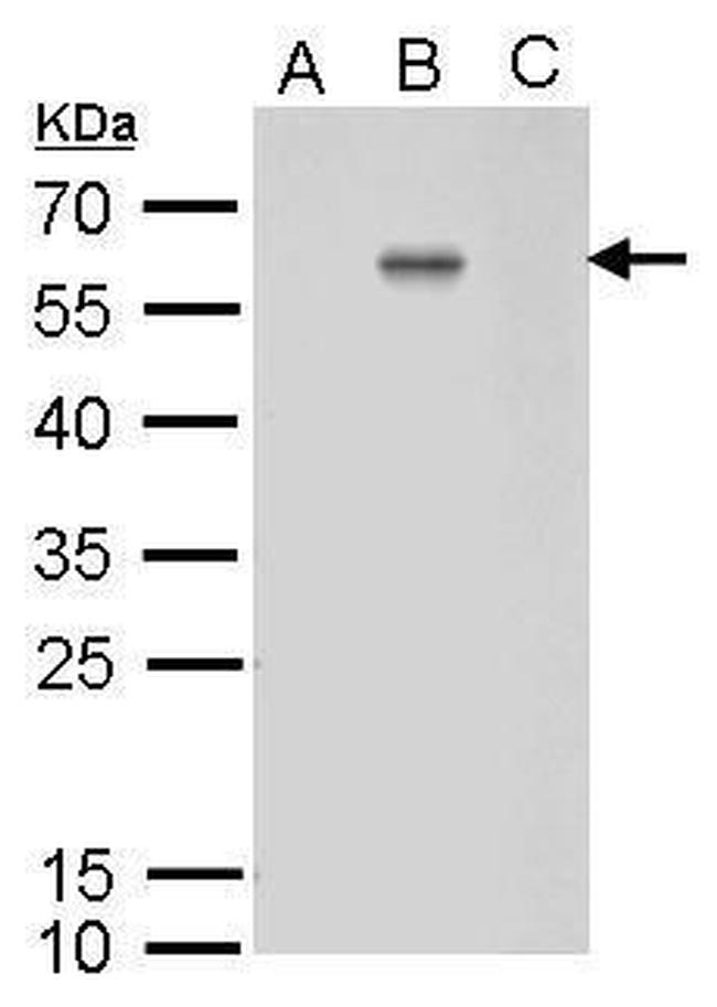 Dengue Virus Type 2 Envelope Antibody in Western Blot (WB)