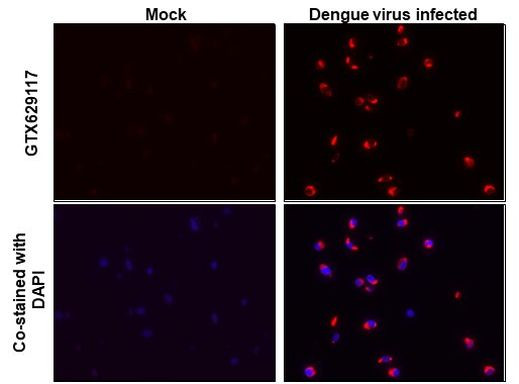 Dengue Virus Type 2 Envelope Antibody in Immunocytochemistry (ICC/IF)