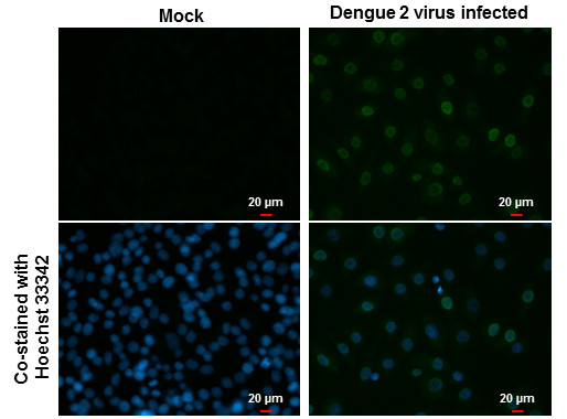 Dengue Virus Type 2 NS5 Antibody in Immunocytochemistry (ICC/IF)