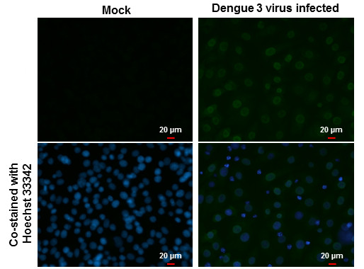 Dengue Virus Type 2 NS5 Antibody in Immunocytochemistry (ICC/IF)