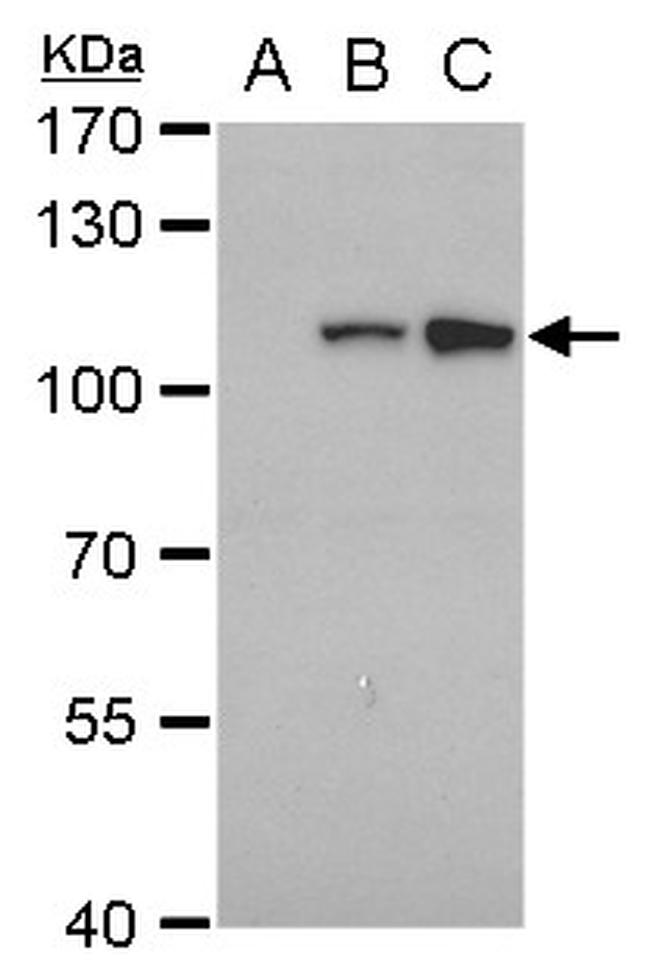 Dengue Virus Type 2 NS5 Antibody in Western Blot (WB)