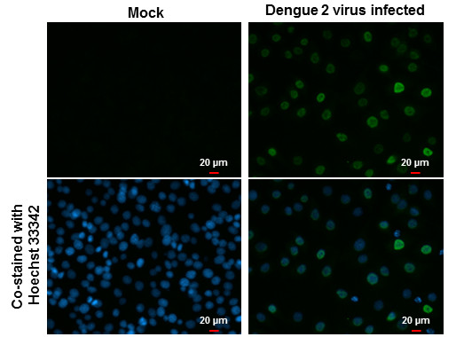 Dengue Virus Type 2 NS5 Antibody in Immunocytochemistry (ICC/IF)