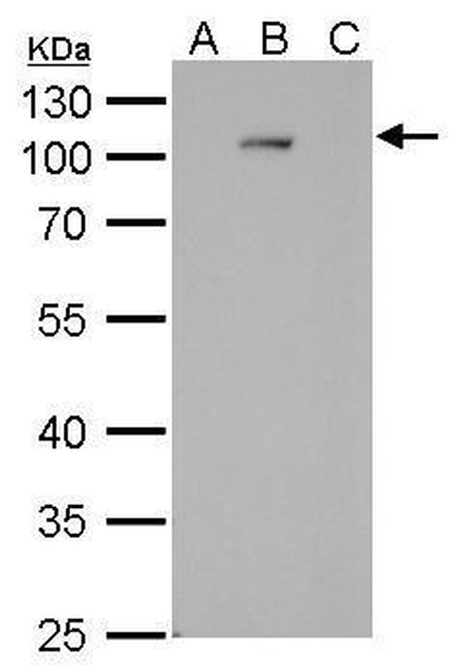 Dengue Virus Type 2 NS5 Antibody in Western Blot (WB)