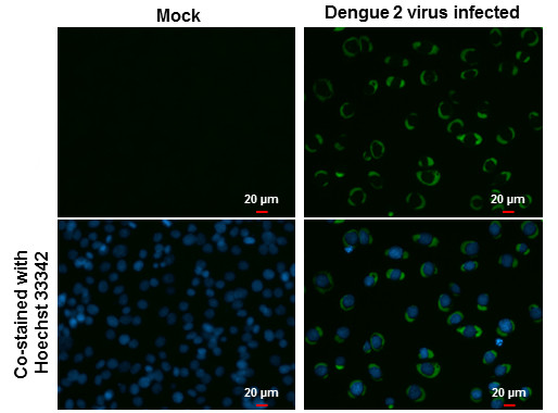 Dengue Virus Type 2 NS3 Antibody in Immunocytochemistry (ICC/IF)