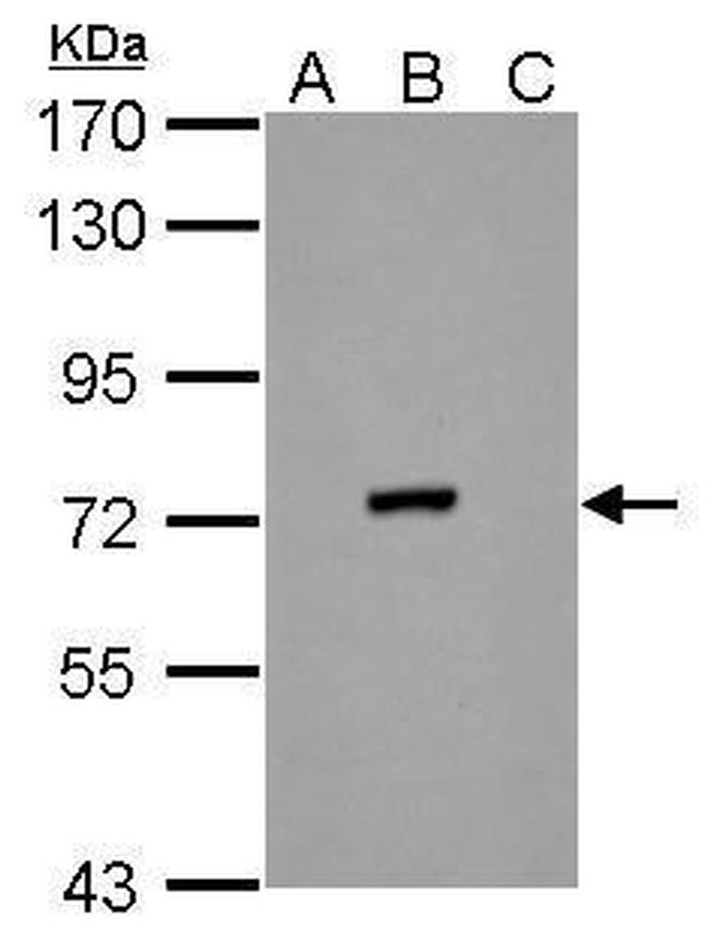 Dengue Virus Type 2 NS3 Antibody in Western Blot (WB)