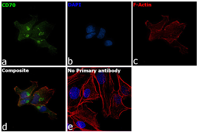 CD70 Antibody in Immunocytochemistry (ICC/IF)