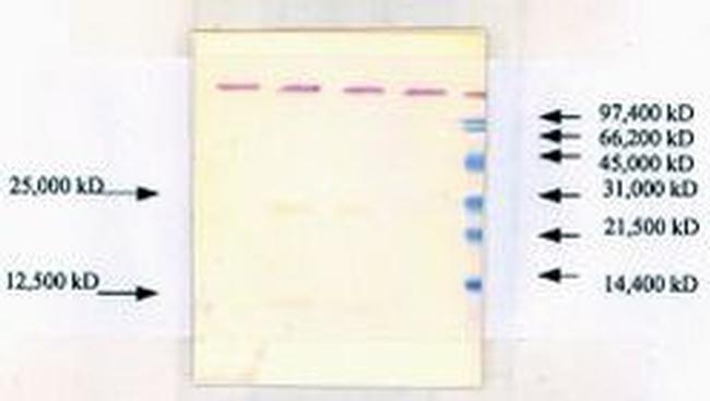 TGF beta-1 Antibody in Western Blot (WB)