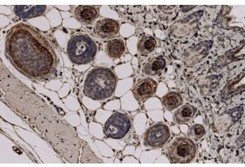 TCHH Antibody in Immunohistochemistry (PFA fixed) (IHC (PFA))