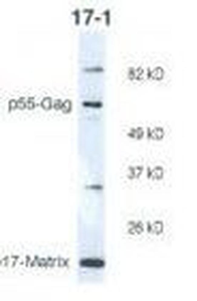 HIV1 p17 Antibody in Western Blot (WB)