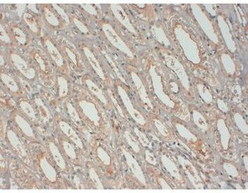 IGF1 Antibody in Immunohistochemistry (Paraffin) (IHC (P))