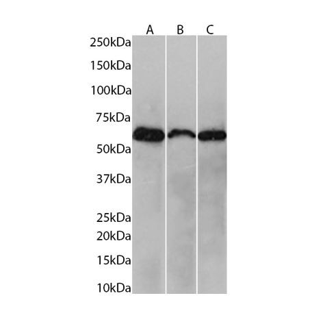 NOX2 Antibody in Western Blot (WB)