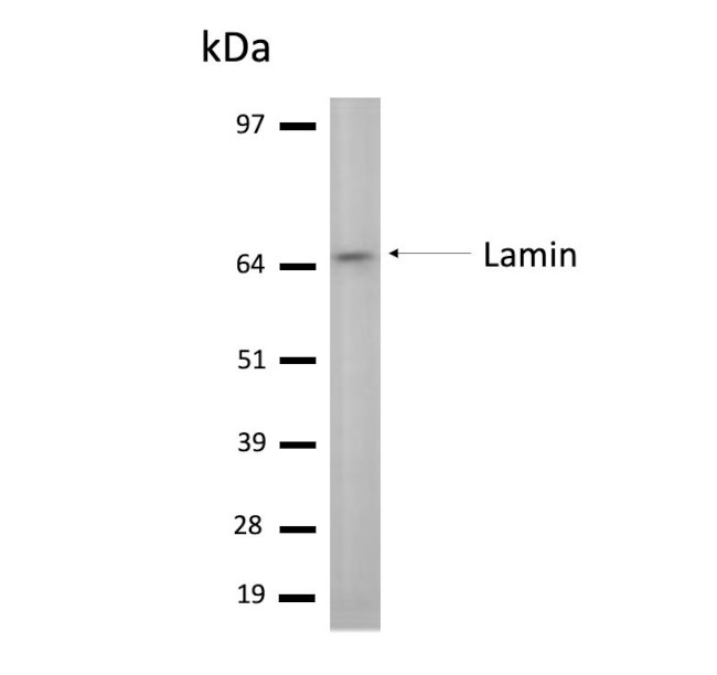 Lamin A/C (R453W) Antibody in Western Blot (WB)