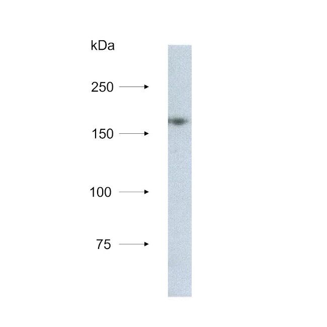 NCAPD3 Antibody in Western Blot (WB)