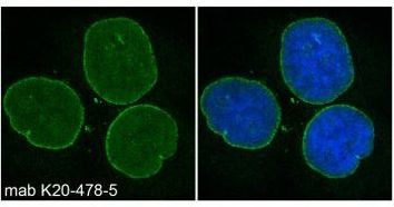 Nesprin 2 Antibody in Immunocytochemistry (ICC/IF)