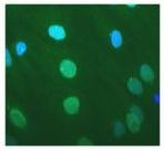 Nesprin 1 Antibody in Immunocytochemistry (ICC/IF)