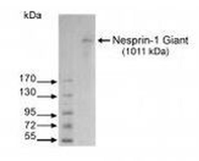 Nesprin 1 Antibody in Western Blot (WB)