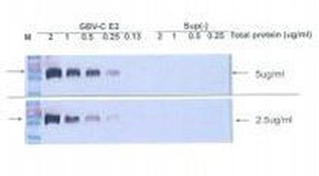 Hepatitis G Virus E2 Antibody in Western Blot (WB)