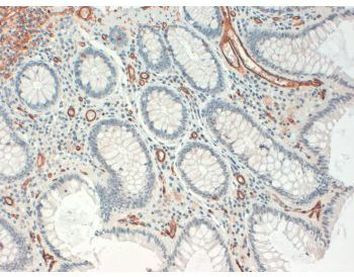 CD34 Antibody in Immunohistochemistry (Paraffin) (IHC (P))