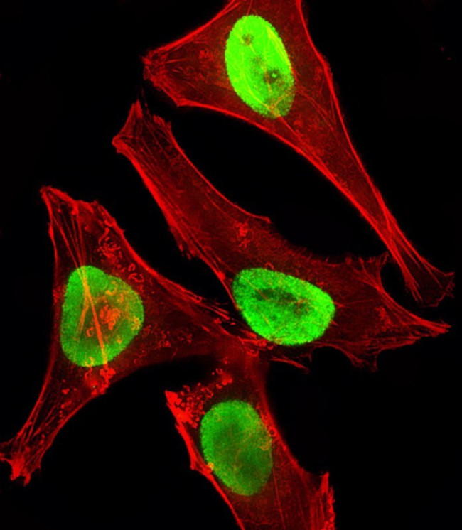 EZH2 Antibody in Immunocytochemistry (ICC/IF)