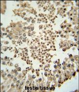 EZH2 Antibody in Immunohistochemistry (Paraffin) (IHC (P))