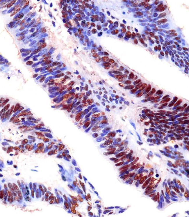 EZH2 Antibody in Immunohistochemistry (Paraffin) (IHC (P))