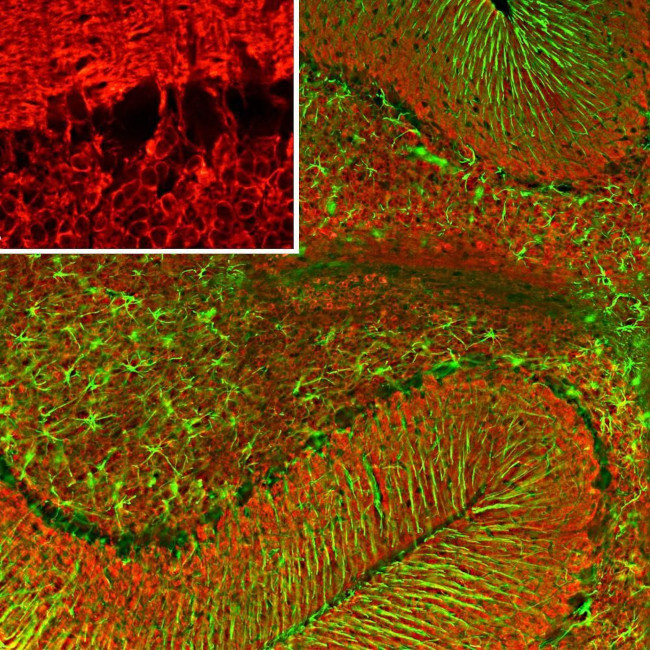 VSNL1 Antibody in Immunohistochemistry (IHC)