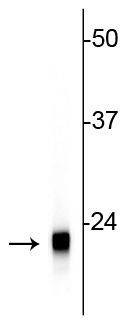 VSNL1 Antibody in Western Blot (WB)