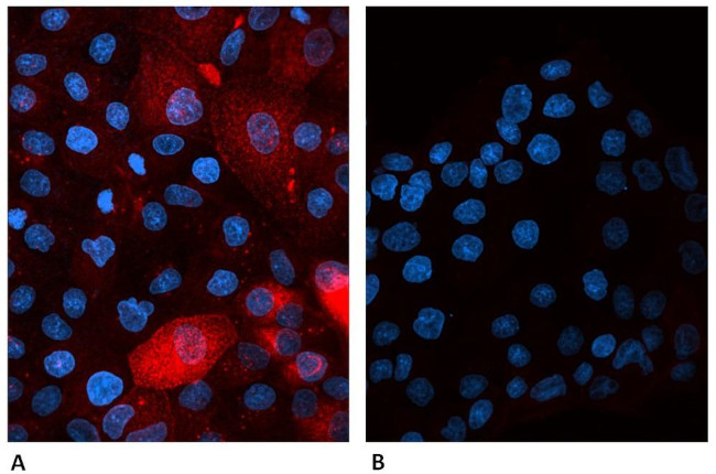 beta-2 Microglobulin Antibody in Immunocytochemistry (ICC/IF)