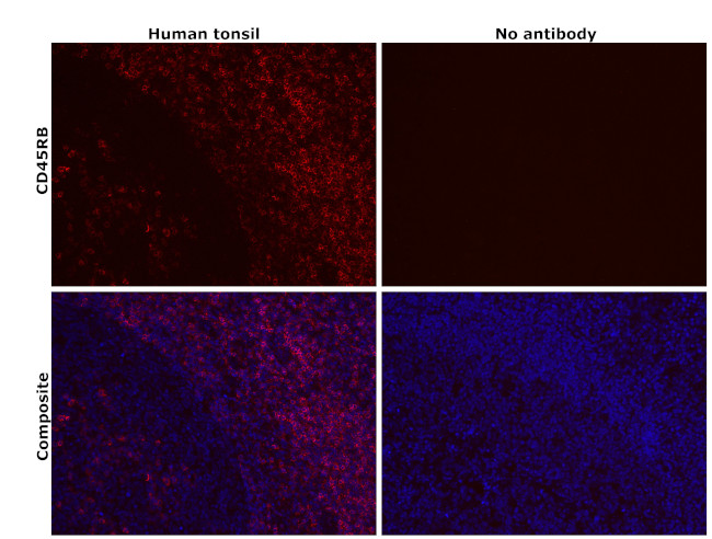 CD45RB Antibody in Immunohistochemistry (Paraffin) (IHC (P))