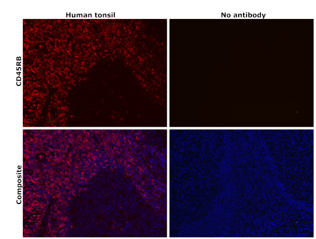 CD45RB Antibody in Immunohistochemistry (Paraffin) (IHC (P))