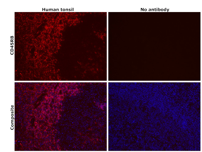 CD45RB Antibody in Immunohistochemistry (Paraffin) (IHC (P))