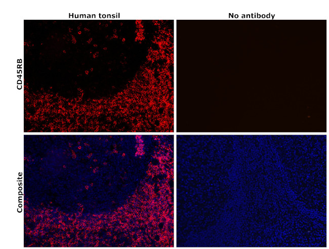 CD45RB Antibody in Immunohistochemistry (Paraffin) (IHC (P))