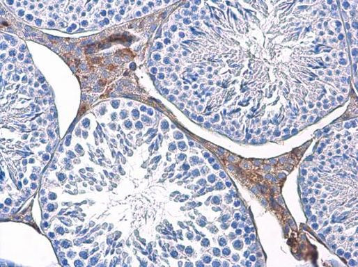 TPI1 Antibody in Immunohistochemistry (Paraffin) (IHC (P))