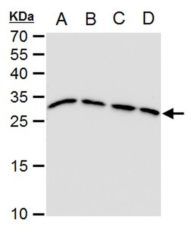 TPI1 Antibody in Western Blot (WB)