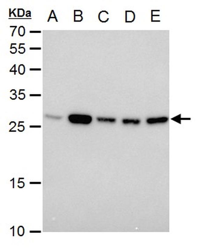 TPI1 Antibody in Western Blot (WB)