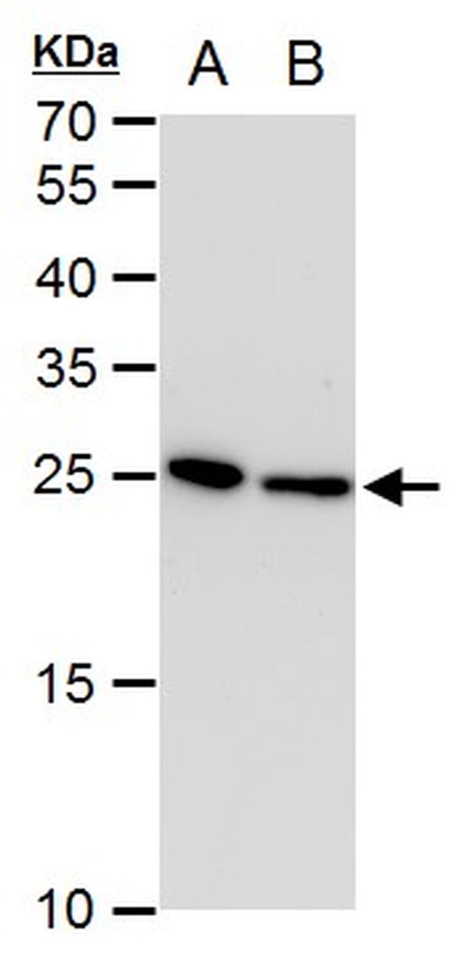 TPI1 Antibody in Western Blot (WB)