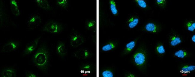 COPD Antibody in Immunocytochemistry (ICC/IF)