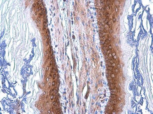 COPD Antibody in Immunohistochemistry (Paraffin) (IHC (P))