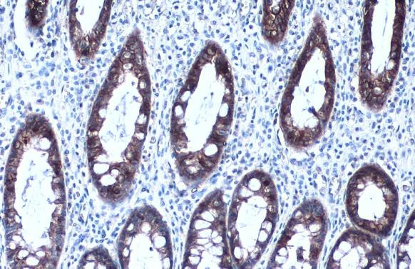 MCT1 Antibody in Immunohistochemistry (Paraffin) (IHC (P))