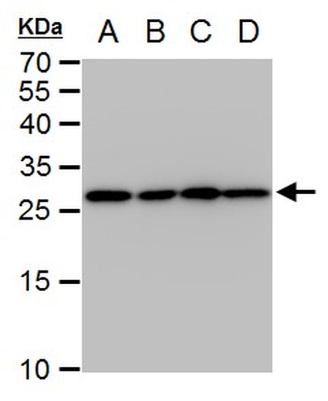 TPI1 Antibody in Western Blot (WB)