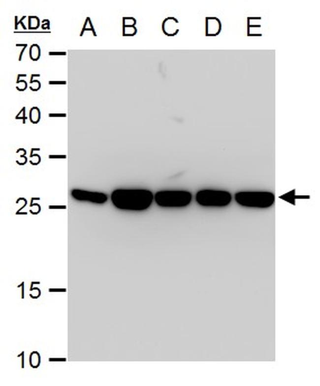 TPI1 Antibody in Western Blot (WB)