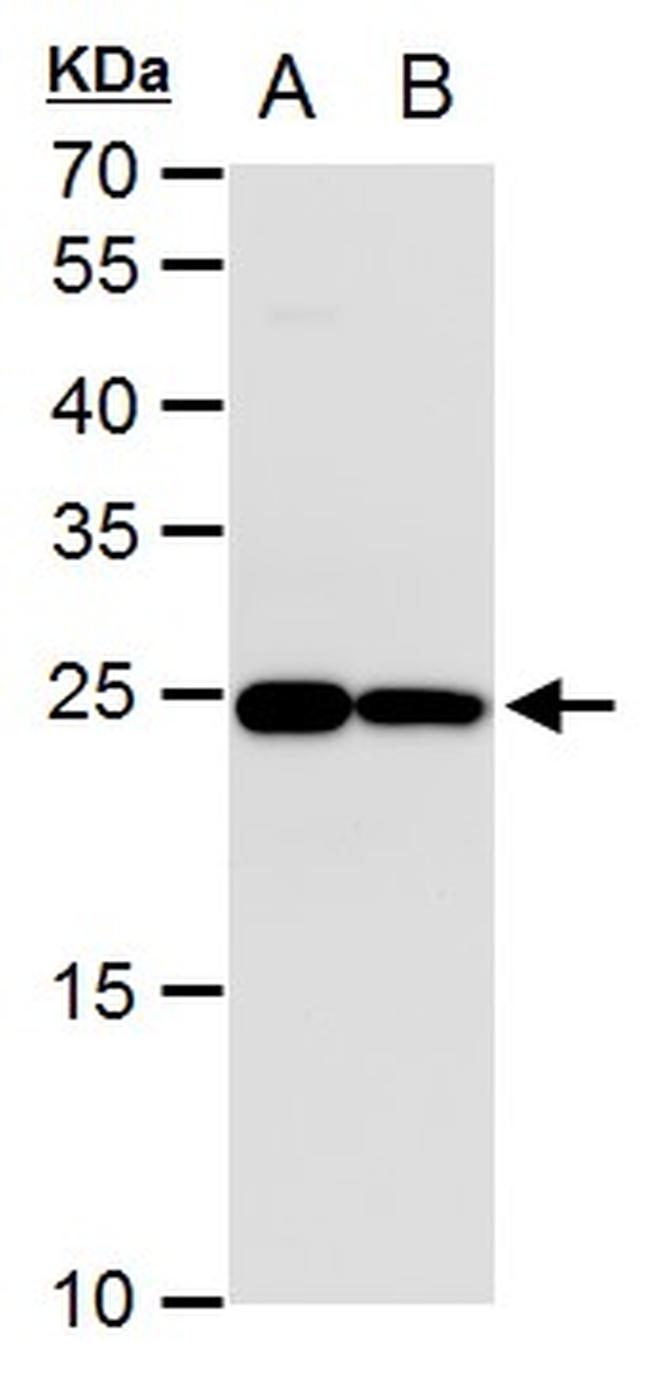 TPI1 Antibody in Western Blot (WB)