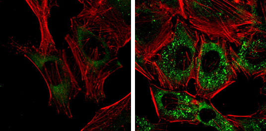 CALCOCO2 Antibody in Immunocytochemistry (ICC/IF)